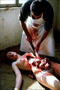 Emergency C-Section Procedure