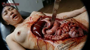 Graphic Autopsy Scene