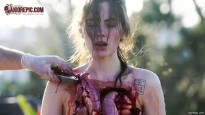 Graphic Surgery Scene