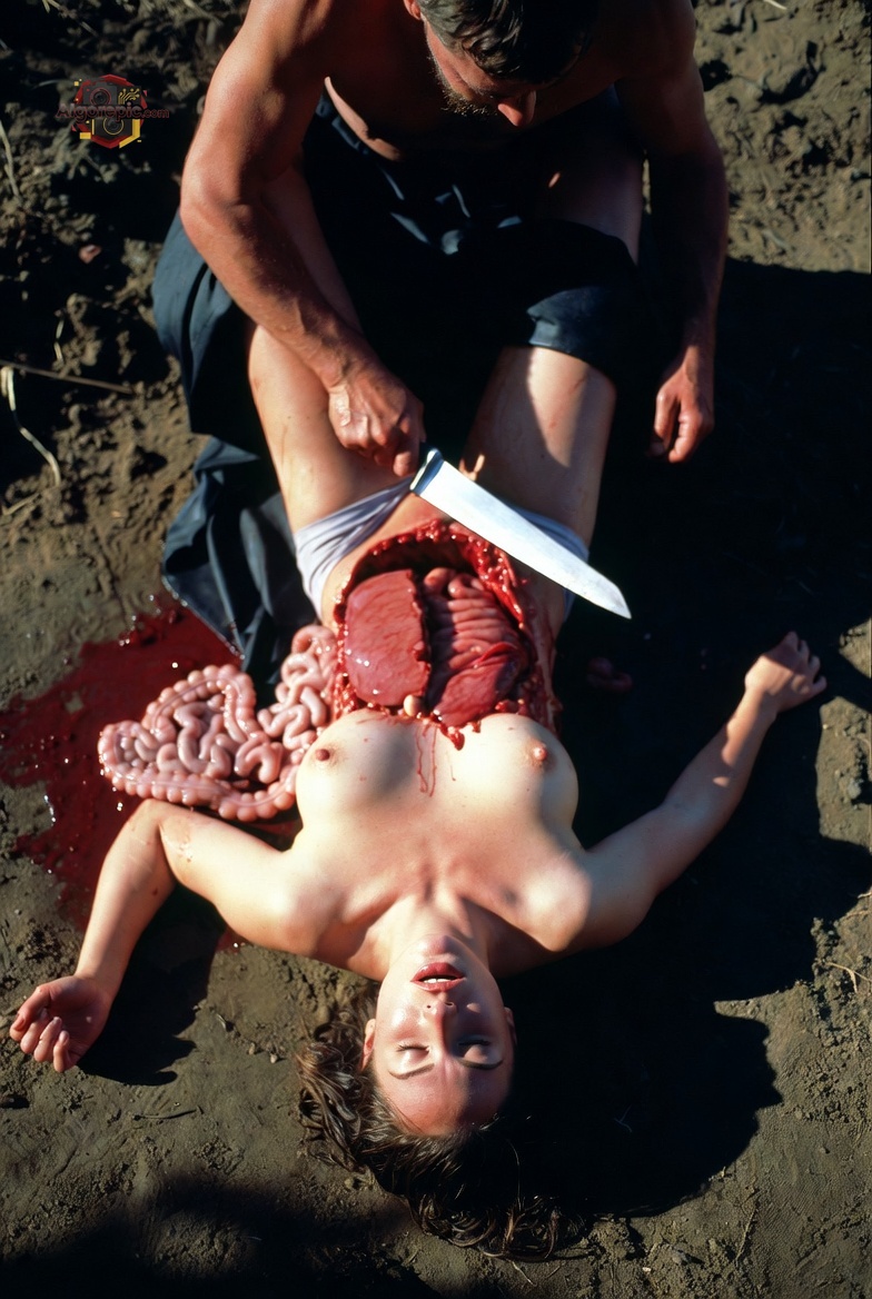 Graphic Surgical Scene - AI Generated Horror