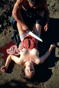 Graphic Surgical Scene