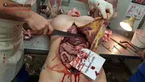 Gruesome Female Autopsy Dissection