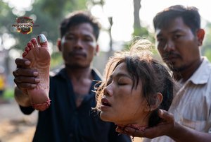 Foot Held in Distress