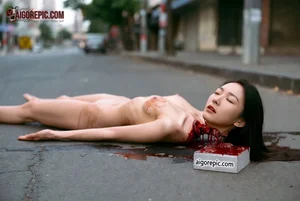 Severed Head on Urban Street