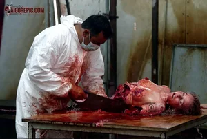 Gruesome Autopsy Scene