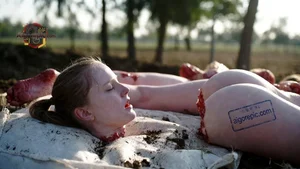 Severed Limbs in Field