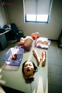 Severed Limbs in Medical Room