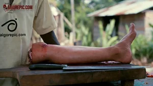 Amputated Leg on Chopping Board