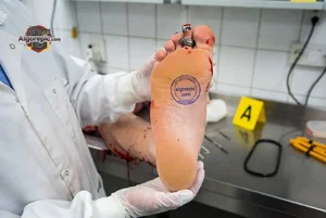 Foot Injury Examination