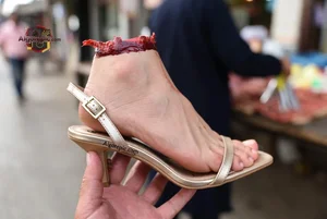 Severed Foot in Heel