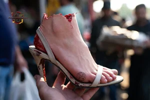 Severed Foot in Heel