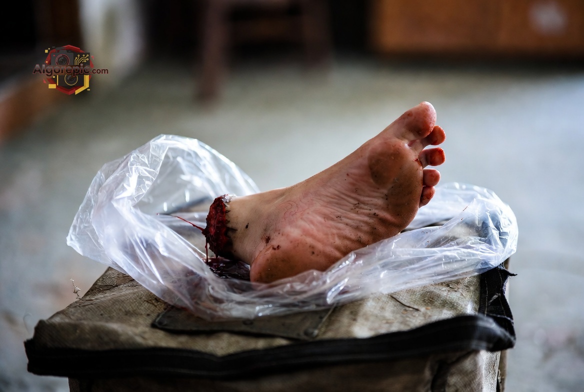 Severed Foot in Plastic - AI Generated Horror
