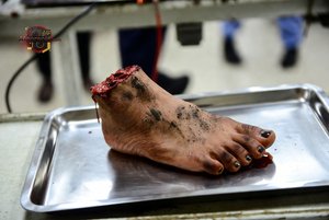 Severed Foot on Tray
