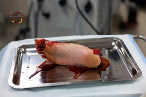 Severed Human Foot