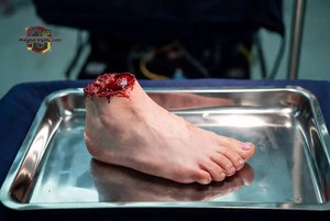Severed Human Foot