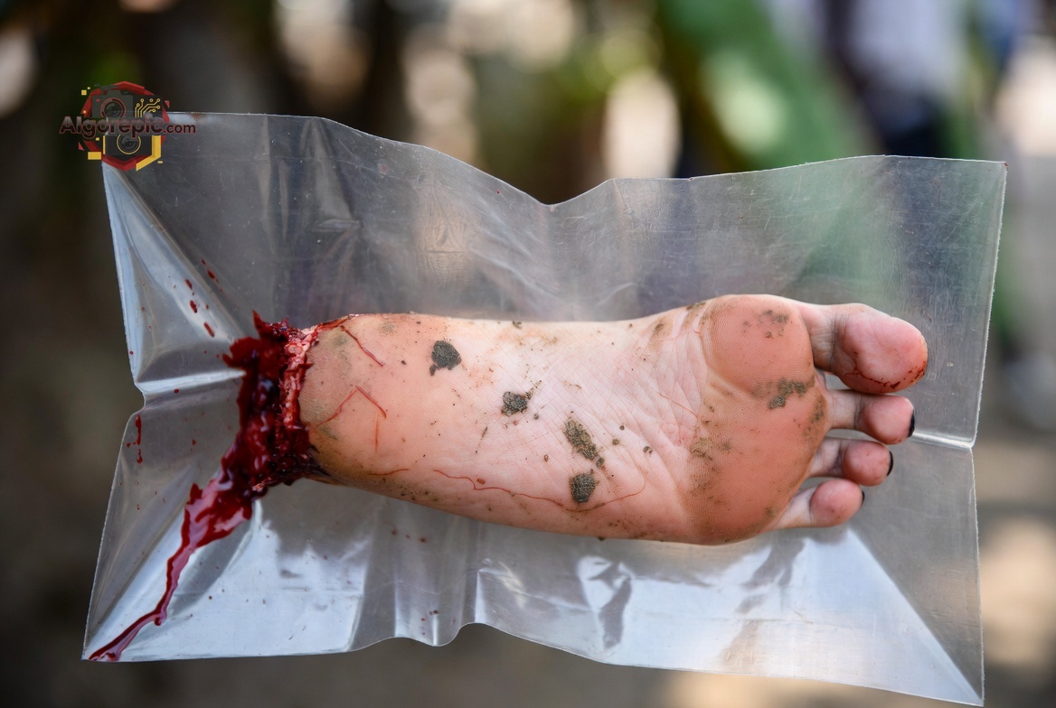 Severed Human Foot - AI Generated Horror