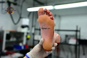 Severed Human Foot