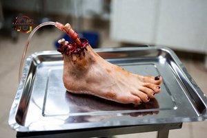 Severed Human Foot
