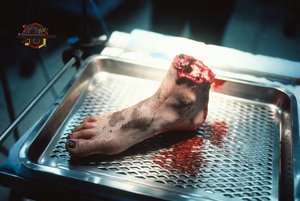 Severed Human Foot