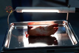 Severed Human Foot