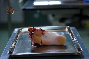 Severed Human Foot