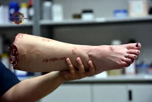 Severed Human Leg