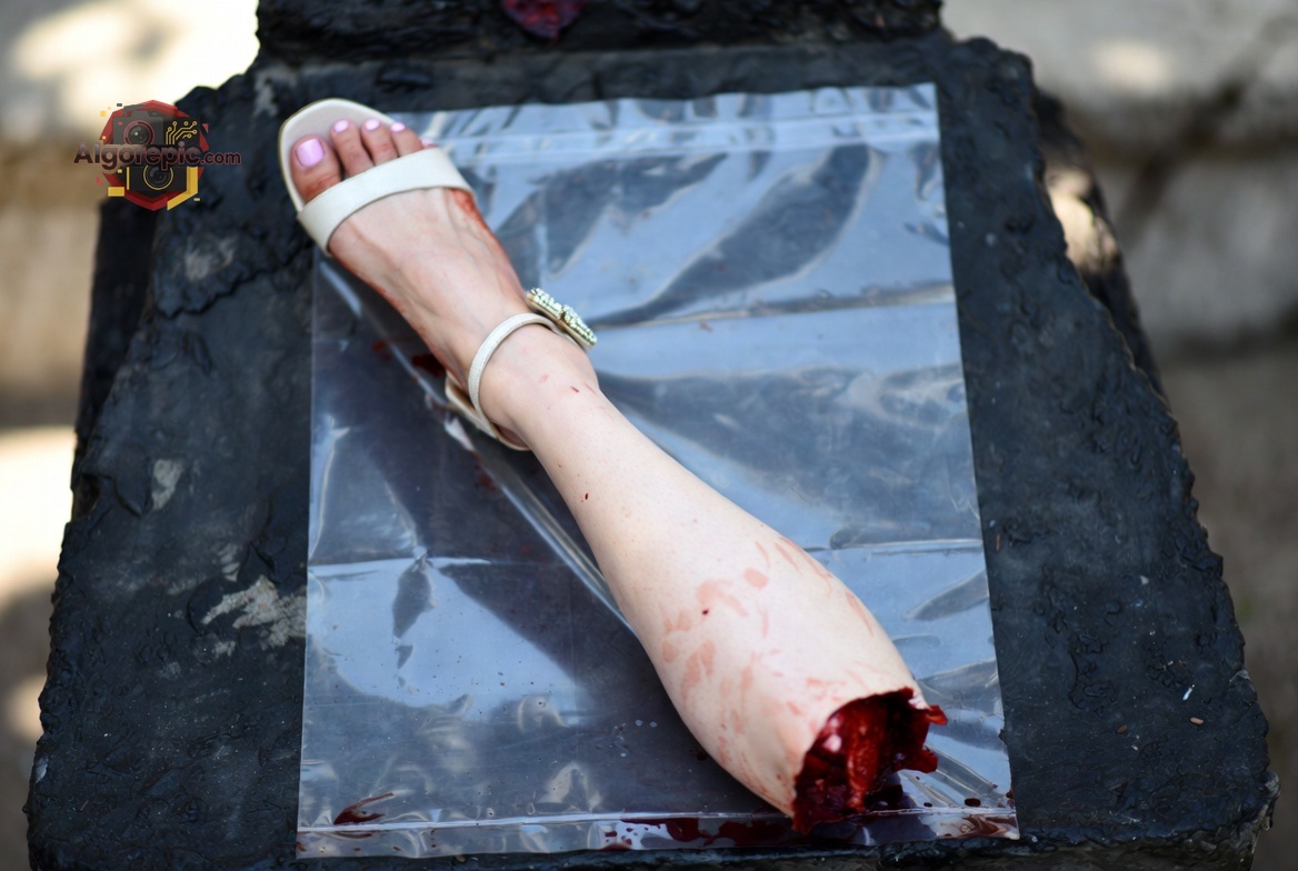 Severed Leg in Heel - AI Generated Horror