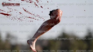 Severed Leg in Mid-Air