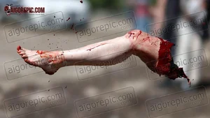 Severed Leg in Mid-Air