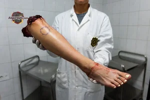 Severed Leg in Morgue