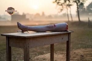 Severed Leg on Table