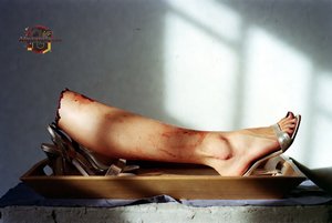 Severed Leg on Tray