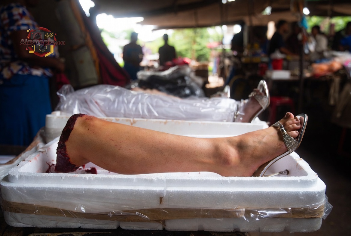 Severed Legs in Market - AI Generated Horror