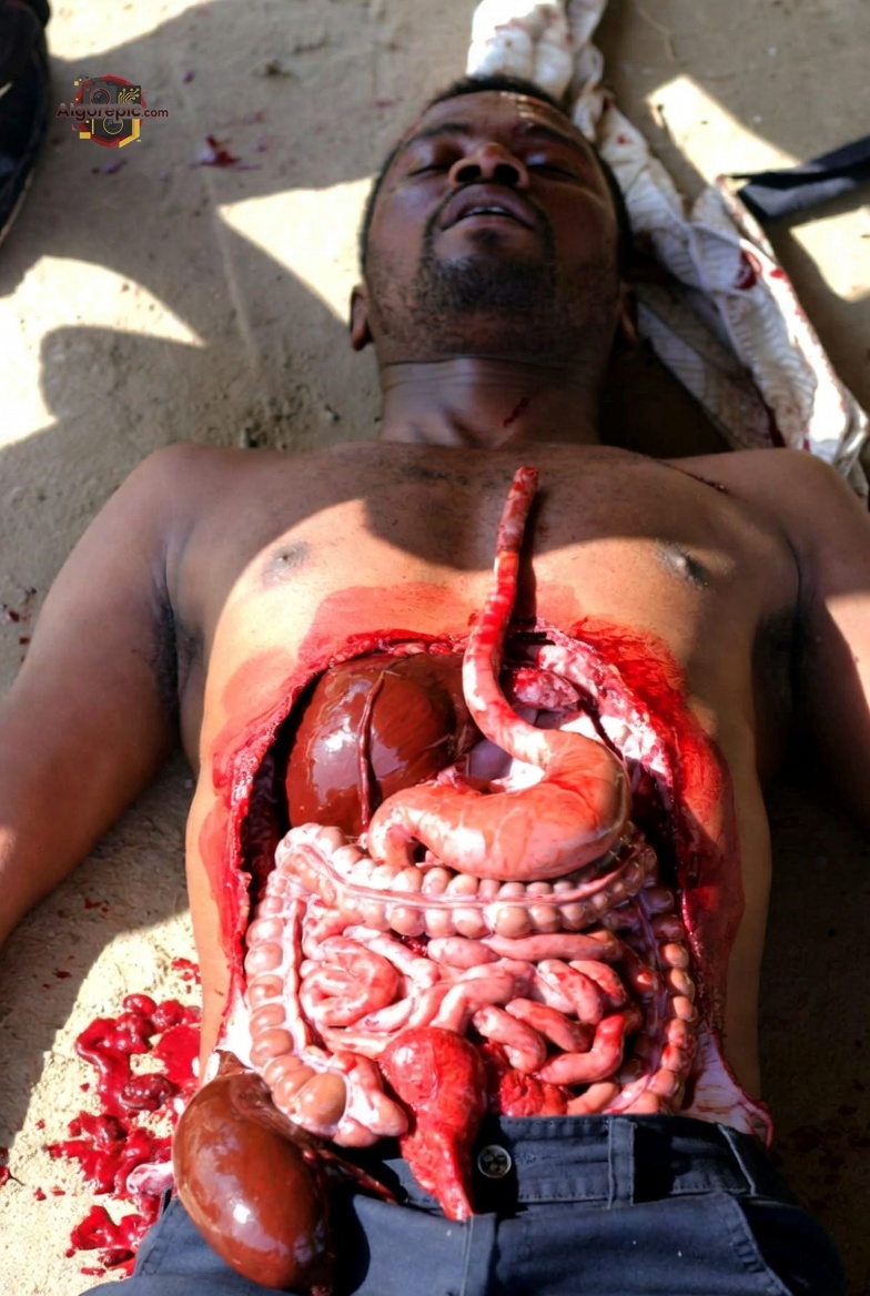 Graphic Abdominal Injury - AI Generated Horror