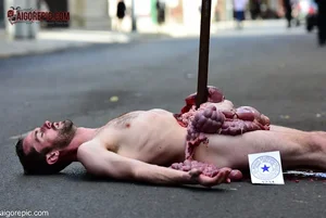 Man with Exposed Intestines