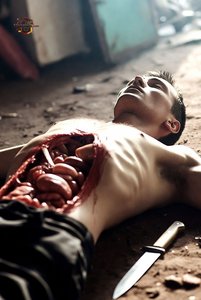 Man with Exposed Organs