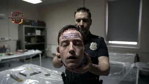 Severed Head in Morgue