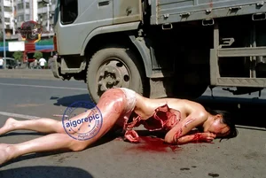 Tragic Street Accident Scene