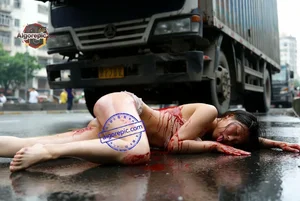 Woman on Road Accident
