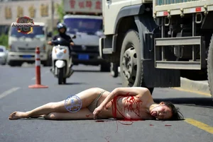 Woman on Road with Injuries