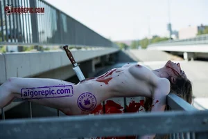 Woman with Knife Wound