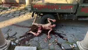Gory Dismembered Man by Truck