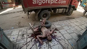 Gory Dismembered Man Street Scene